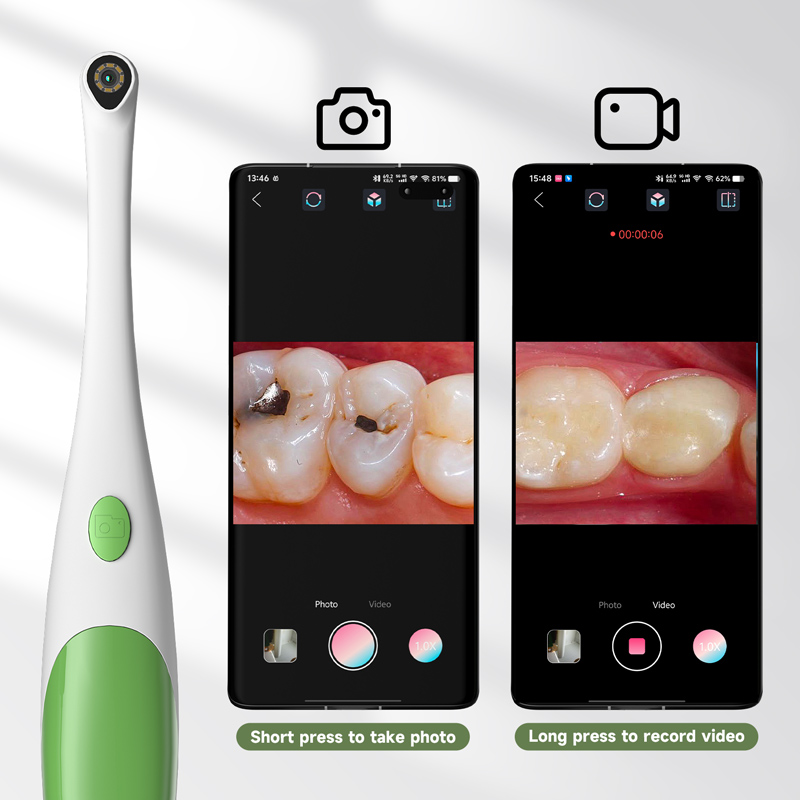 Endoscopio 3 in 1 per Android/ - Endoscope Inspection Camera recensione e prezzo